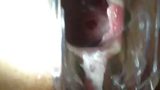 Загас барих шугам нь бэлгийн харьцаанд сайн байдаг